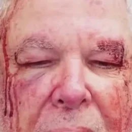 Vítima de violência política no Rio só conseguiu fazer perícia após ir à Corregedoria
