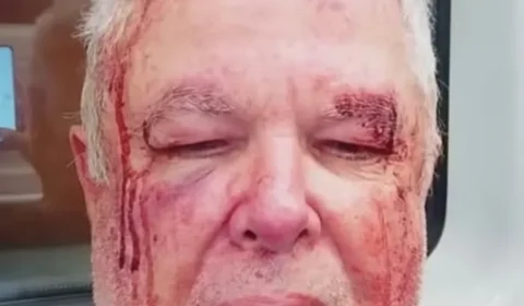 Vítima de violência política no Rio só conseguiu fazer perícia após ir à Corregedoria