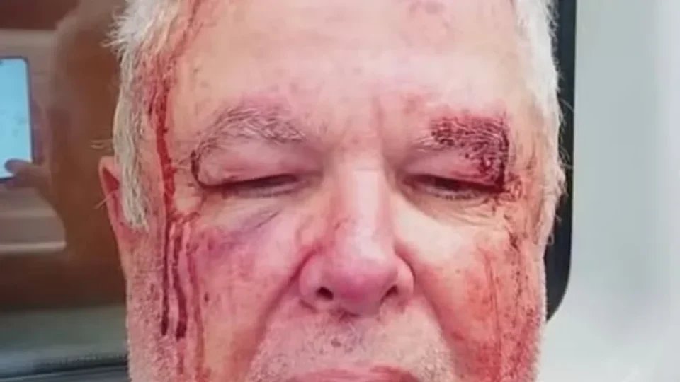 Vítima de violência política no Rio só conseguiu fazer perícia após ir à Corregedoria