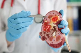 Veja os 9 alimentos mais indicados por especialistas para cuidar da saúde dos rins
