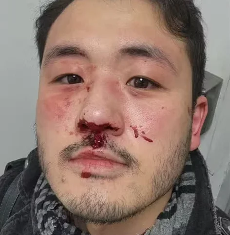 Professor é espancado em estação do Metrô de SP e relata ataque homofóbico