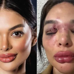 Dentista já havia acusado empresário de estupro marital antes de agressão