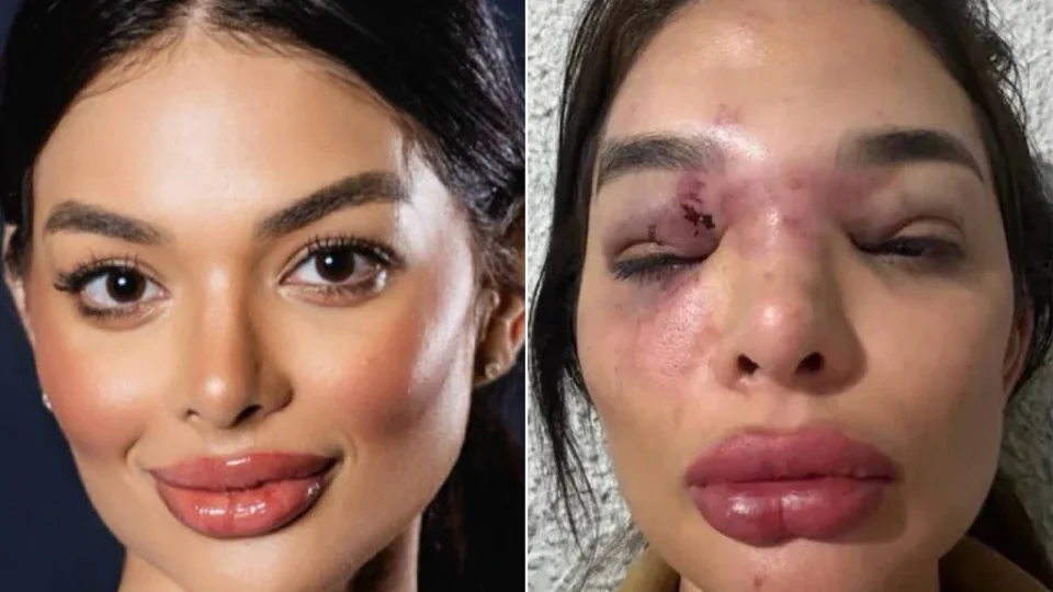 Dentista já havia acusado empresário de estupro marital antes de agressão