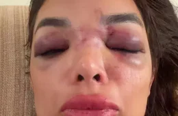 Empresário é preso por suspeita de agredir mulher com taco de beisebol em SP