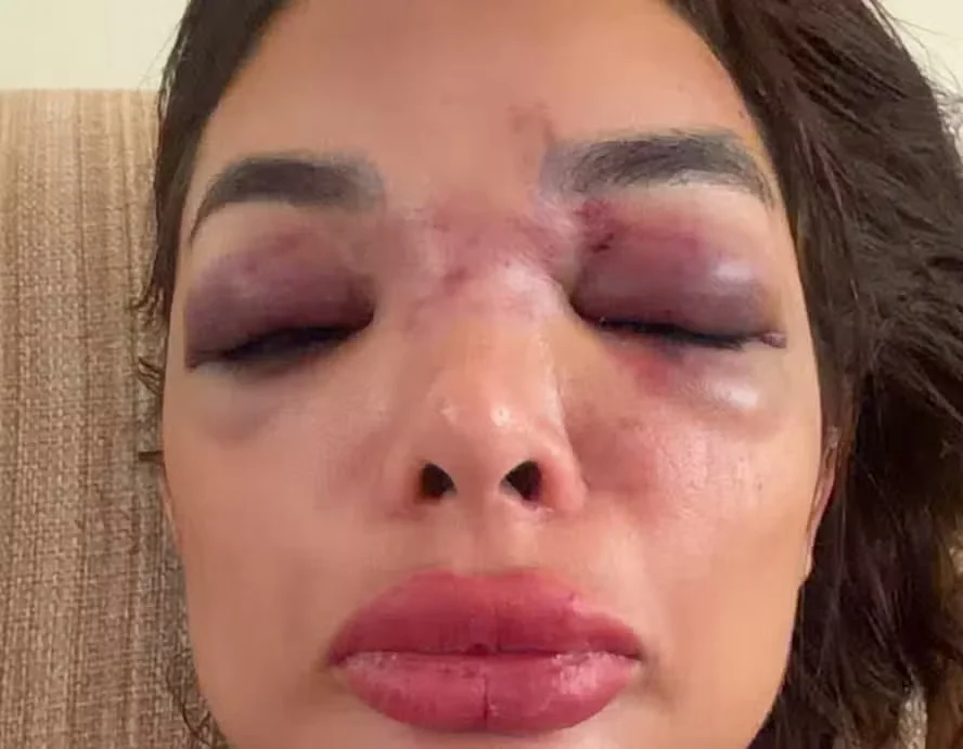 Empresário é preso por suspeita de agredir mulher com taco de beisebol em SP