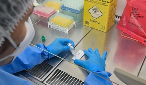 Anvisa atualiza regras sobre controle de qualidade em laboratórios