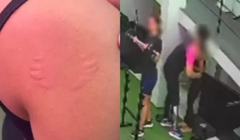 Mulher denuncia assédio após ser mordida por instrutor em academia no Recife