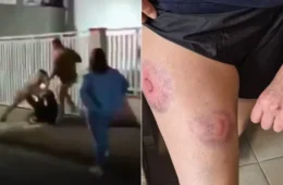 Deputado bolsonarista propõe homenagem a PMs que agrediram candidata do PT