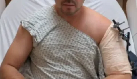 ‘Golpe do retrovisor’: cirurgião é baleado dentro de carro blindado durante assalto no RJ