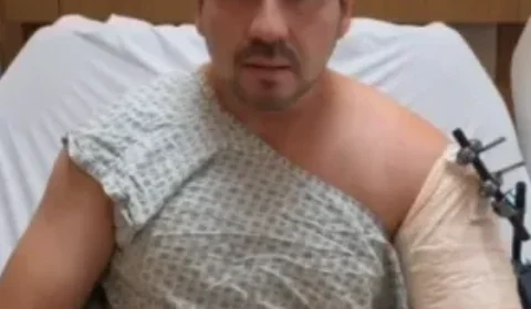 ‘Golpe do retrovisor’: cirurgião é baleado dentro de carro blindado durante assalto no RJ