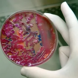 Cientistas identificam vírus no esgoto do Reino Unido que pode ser usado contra superbactéria