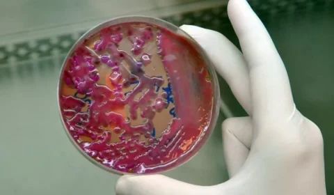 Cientistas identificam vírus no esgoto do Reino Unido que pode ser usado contra superbactéria