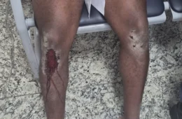 Jovem diz ter sido espancado por bolsonaristas antes de ato pró-Lula no Rio