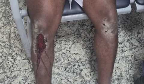 Jovem diz ter sido espancado por bolsonaristas antes de ato pró-Lula no Rio