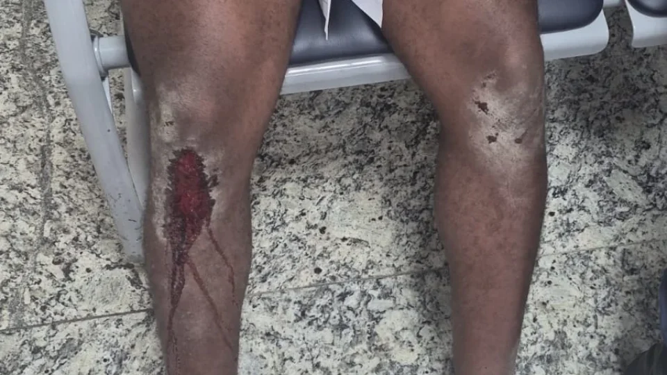 Jovem diz ter sido espancado por bolsonaristas antes de ato pró-Lula no Rio