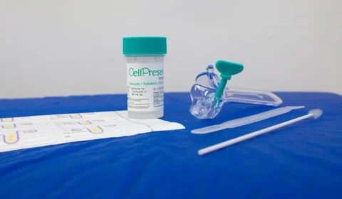 SUS detecta quase 10 mil testes positivos para HPV de alto risco