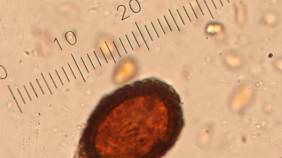 Comprimidos para emagrecer com ovos de tênia podem ser prejudiciais à saúde